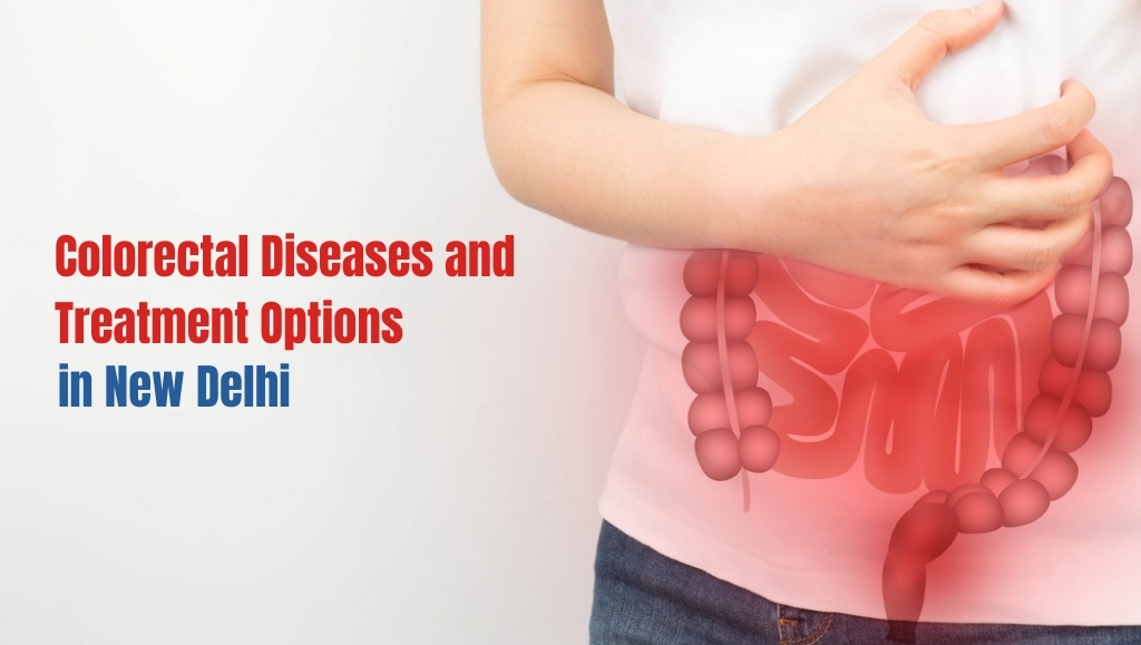 ⁠All you need to know about Colorectal Diseases and their Treatments