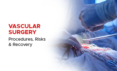 Vascular Surgery: Procedures, Risks and Recovery