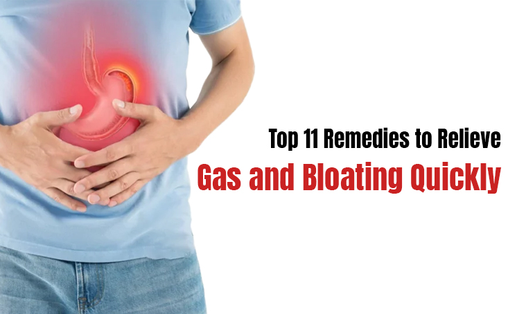 Top 11 Remedies to Relieve Gas and Bloating Quickly