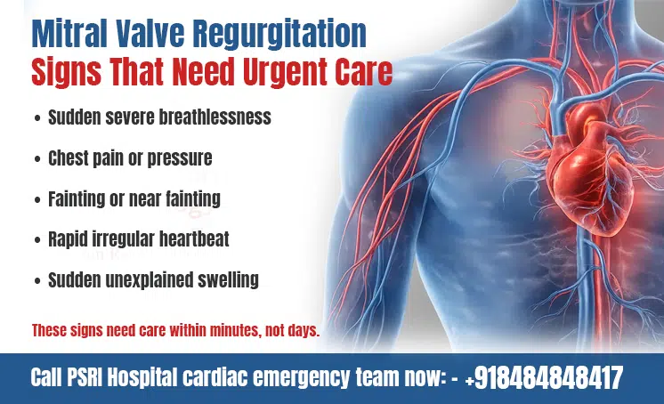 mitral valve regurgitation signs