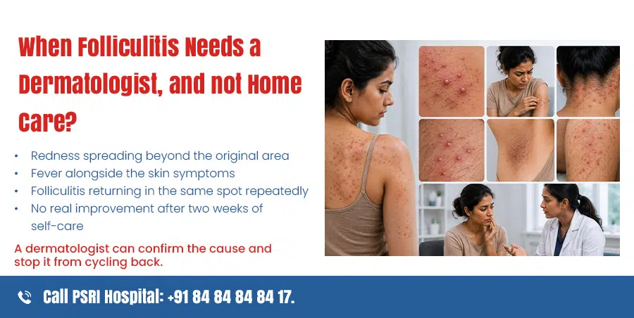 when folliculitis needs dermatologist