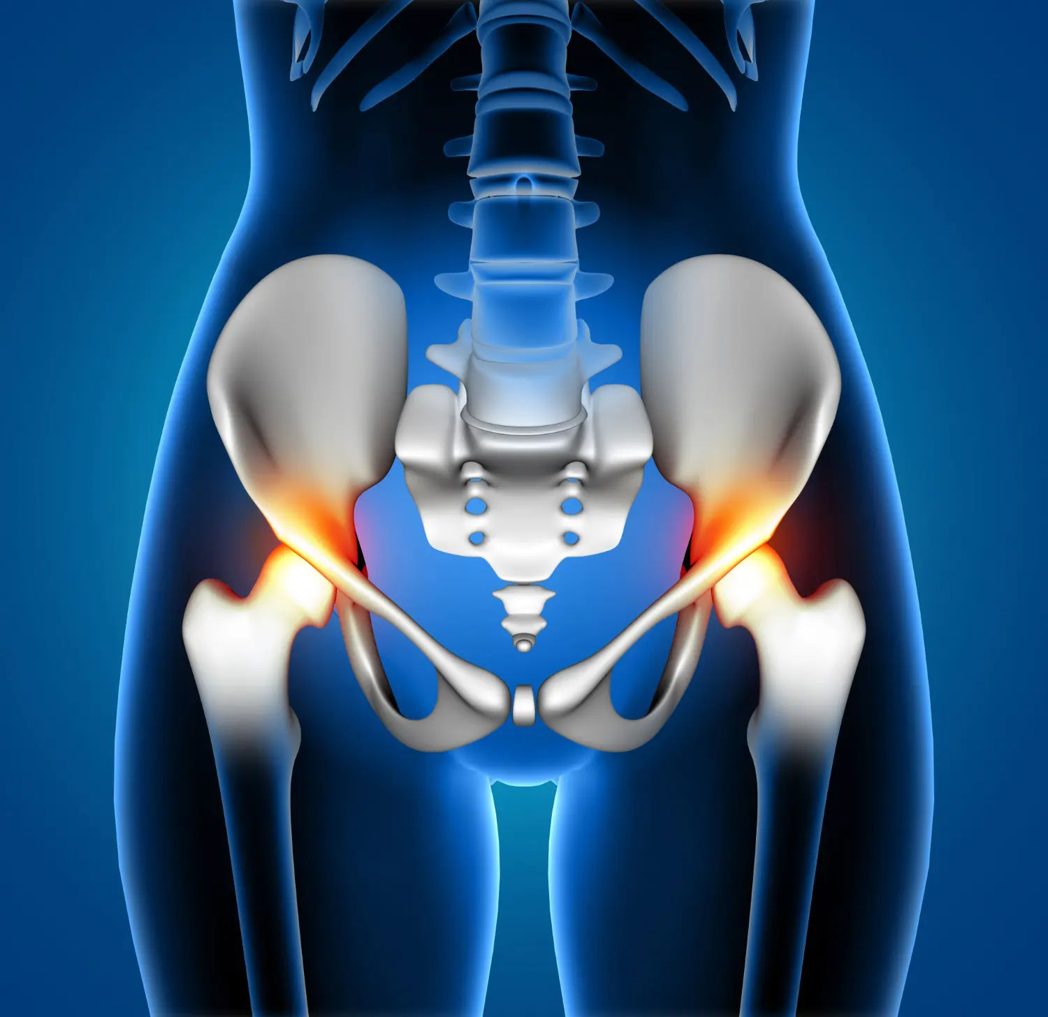 Why a hip replacement second opinion matters