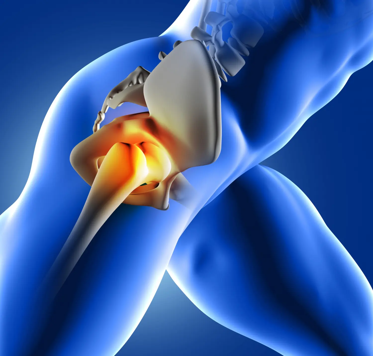 Hip replacement second opinion