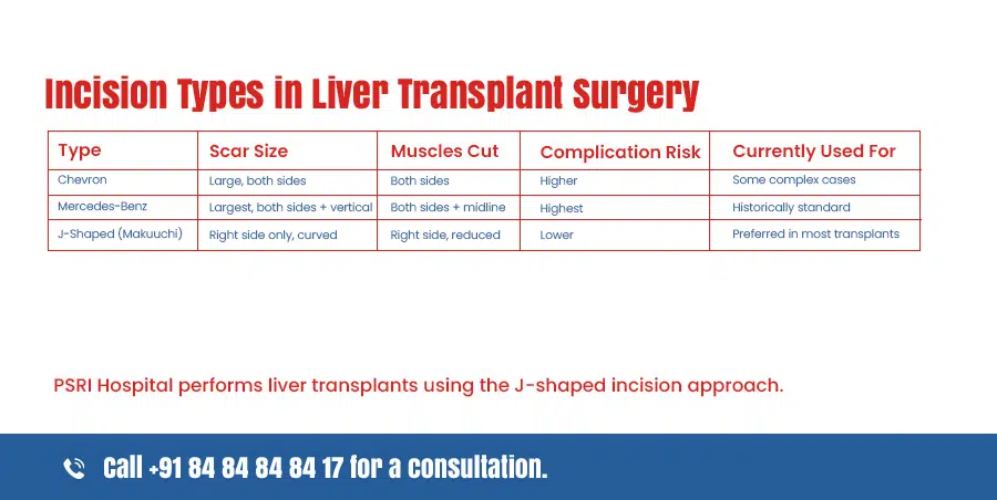 incision types in liver transplant surgery